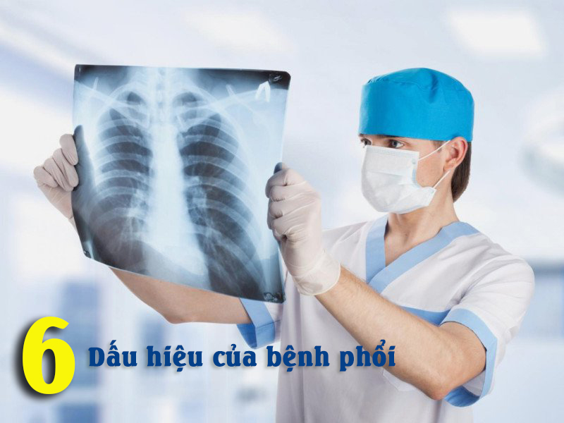 6 Dấu hiệu của bệnh phổi mọi người cần chú ý