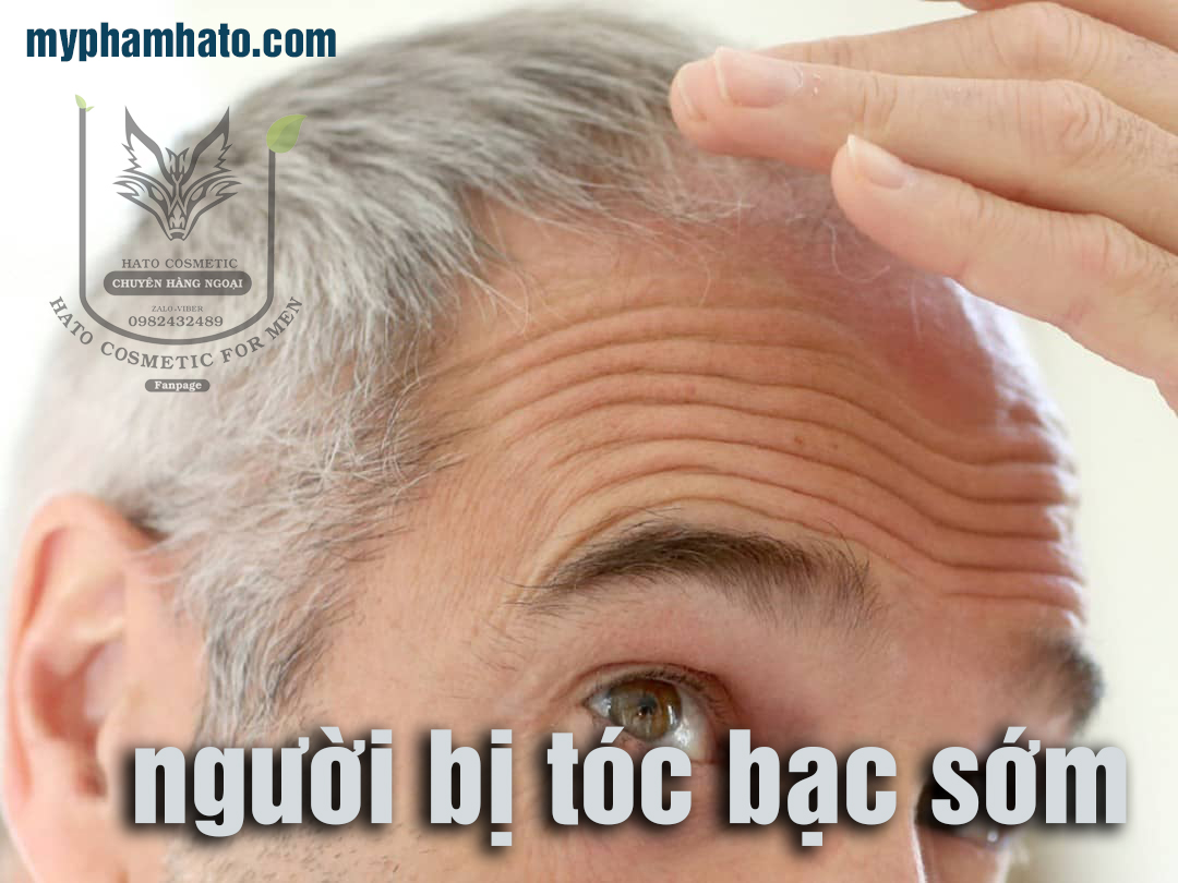 Đối tượng phù hợp để sử dụng sản phẩm viên hỗ trợ giảm tóc bạc sớm Anti Gray Hair 7050